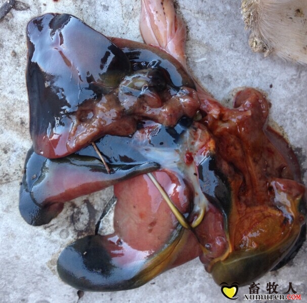 肝坏死颜色不一.jpg