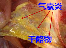 气囊炎.jpg