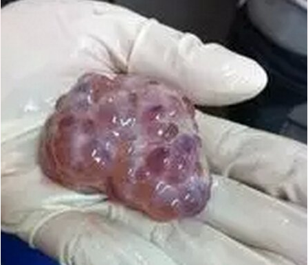 研究：卵泡发育期淀粉作为主要能量来源的日粮 可提高母猪繁殖效率